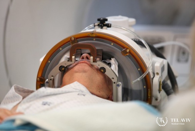 МРТ - направленный фокусированный ультразвук