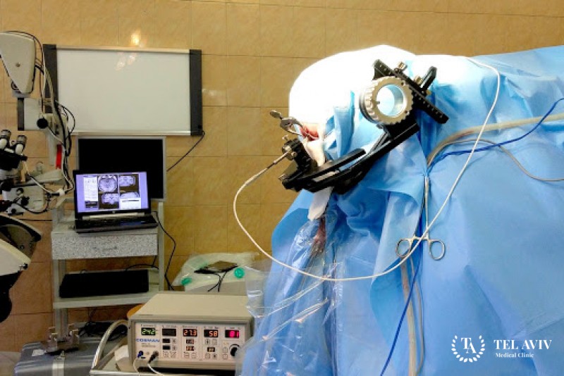 Стереотаксическая радиочастотная хирургия