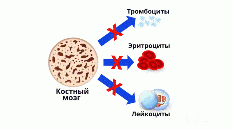 Апластическая анемия