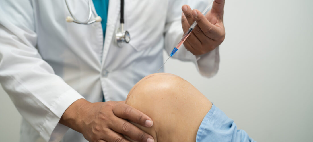 Asian doctor inject Hyaluronic acid platelet rich plasma into the knee of senior woman to walk without pain.